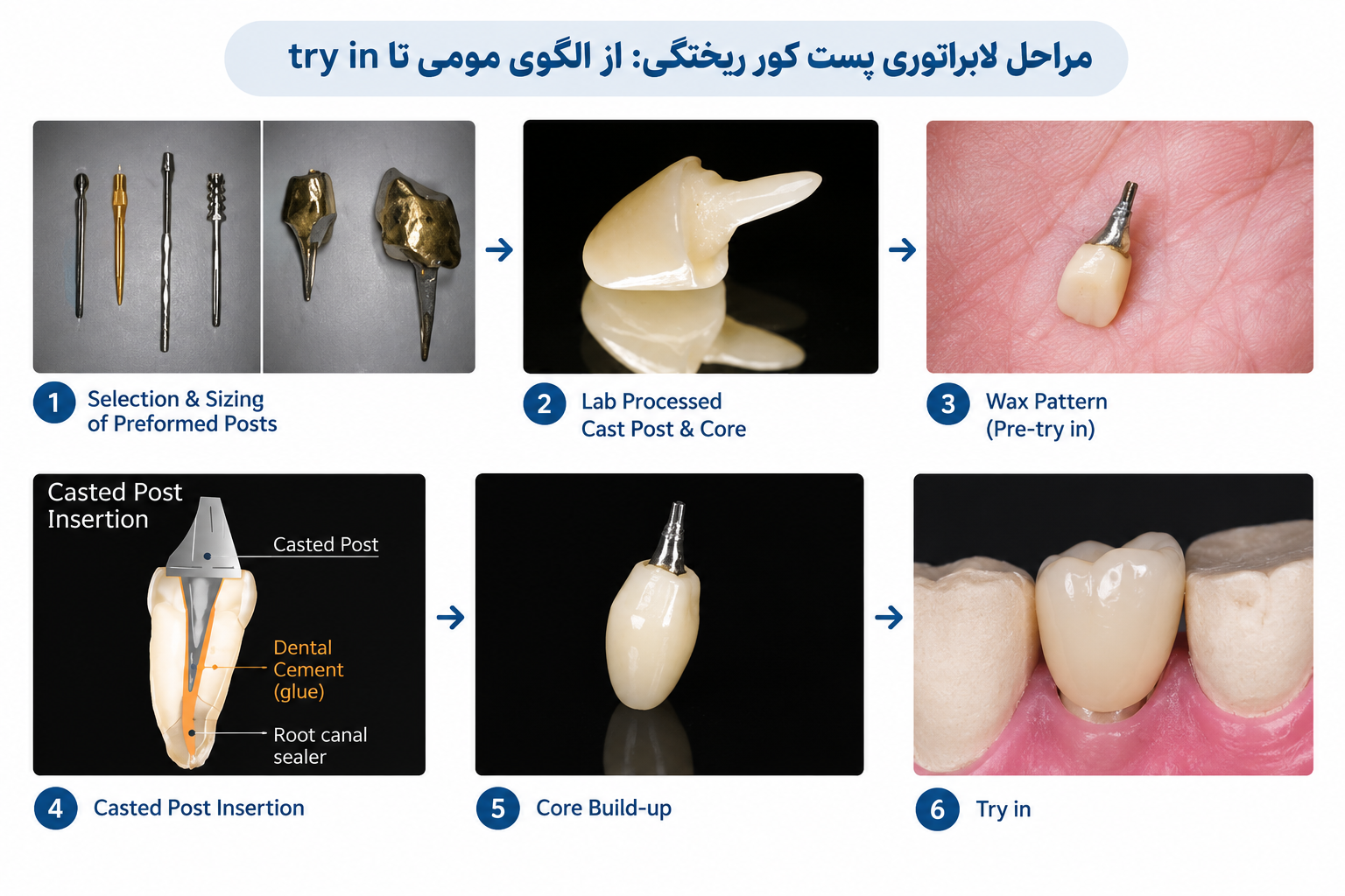 مراحل لابراتوری پست کور ریختگی: از الگوی مومی تا try in