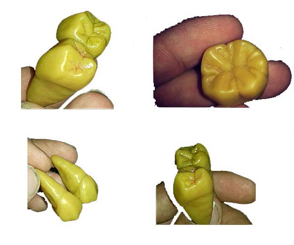 موم مورفولوژی