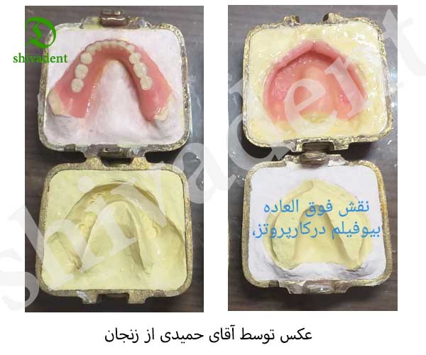 بیوفیلم گلوری