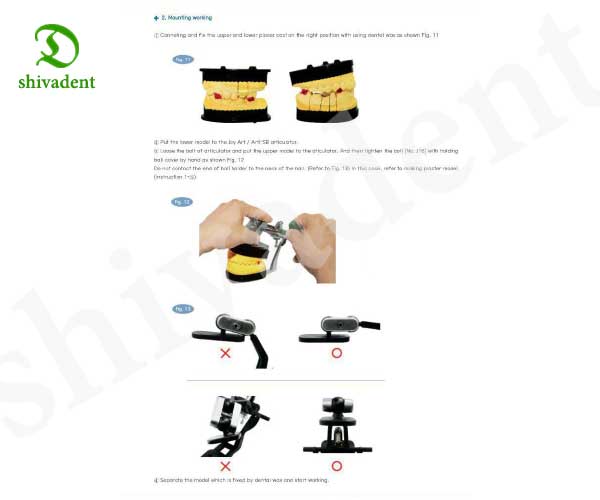 آرتیکولاتور آلفادنت