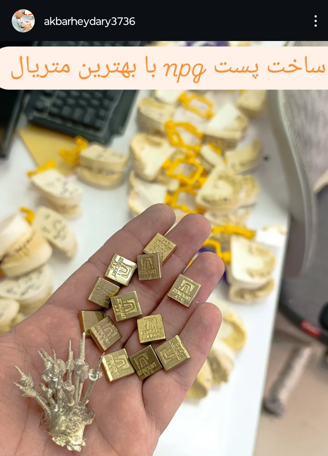 آلیاژ NPG