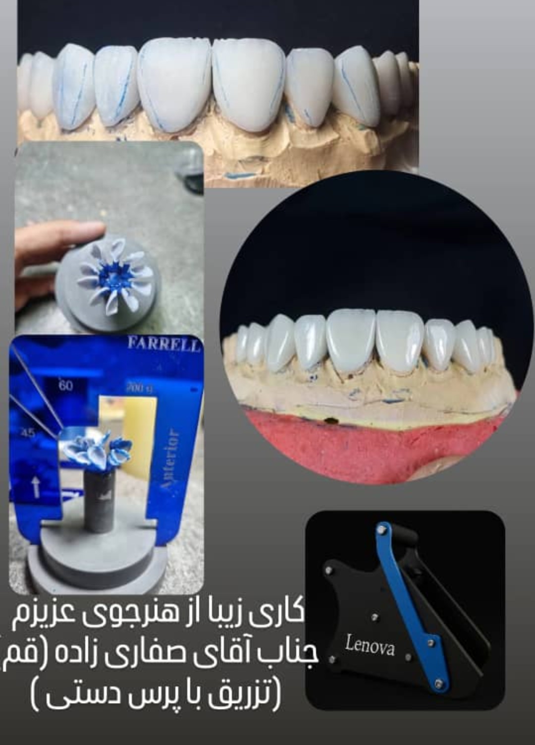 پرس دستی(تزریق اینگات)